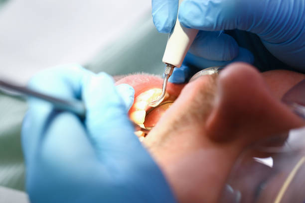 Best Cracked Tooth Emergency Dentist  in Monona, IA